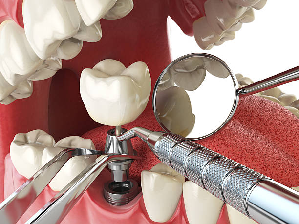 Best Emergency Treatment for Jaw Pain or Injury in West End, NY